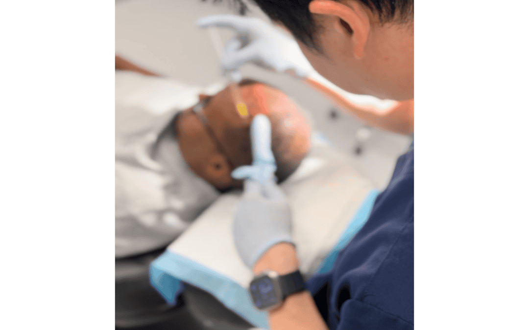 How to Maintain Healthy Hair After Hair Restoration