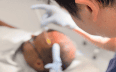 How to Maintain Healthy Hair After Hair Restoration