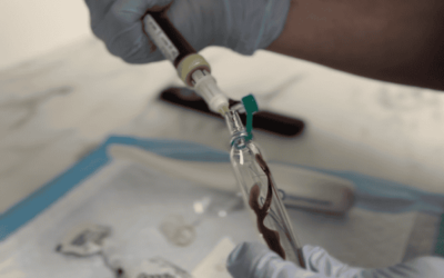 What is PRP Hair Treatment?
