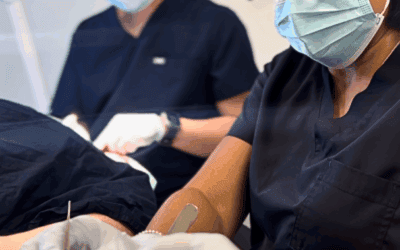 Full Guide to FUE Hair Transplants