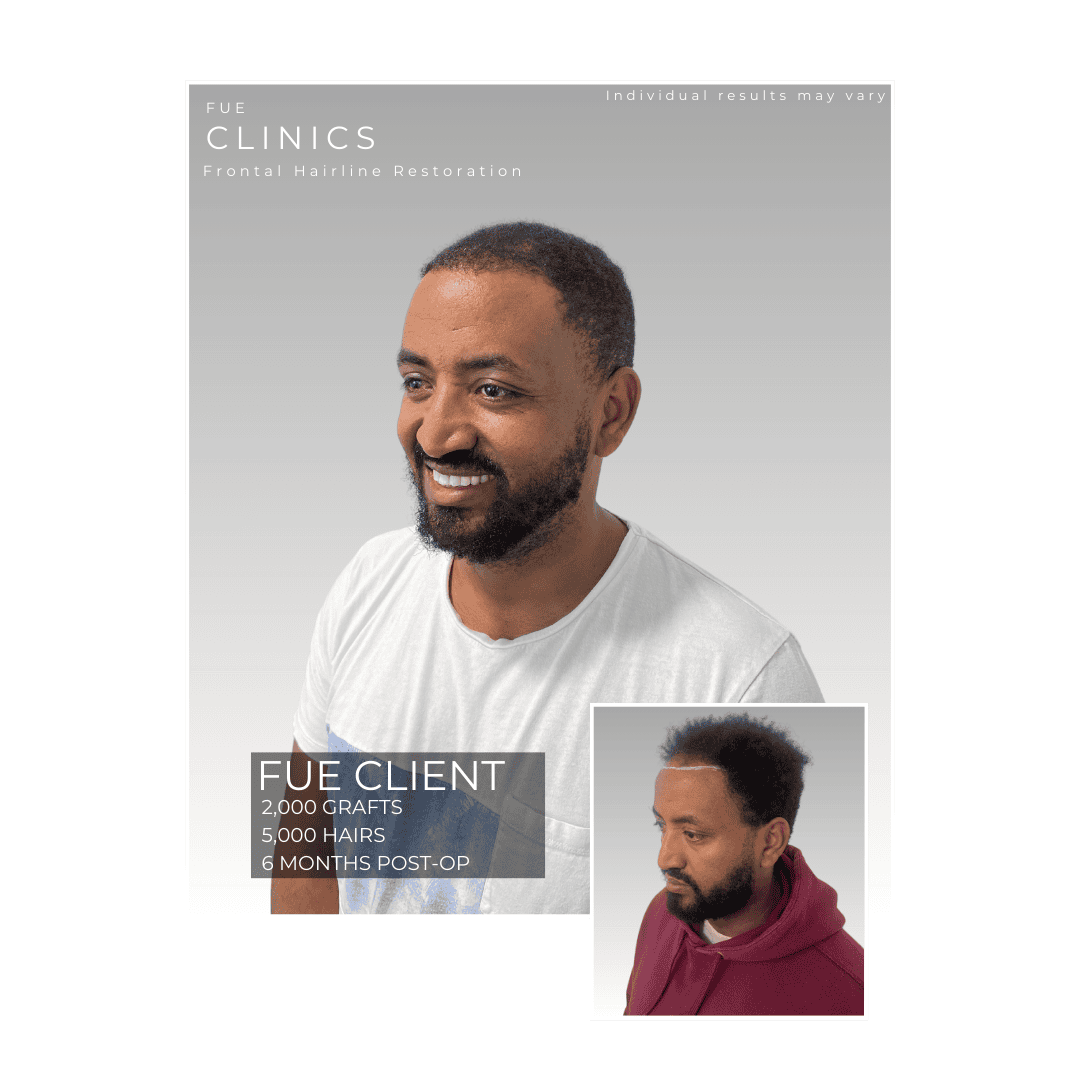 Afro-Hair-Client-3