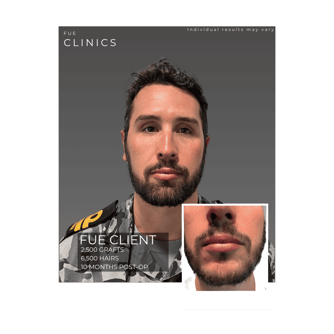 Male-Client-1-1
