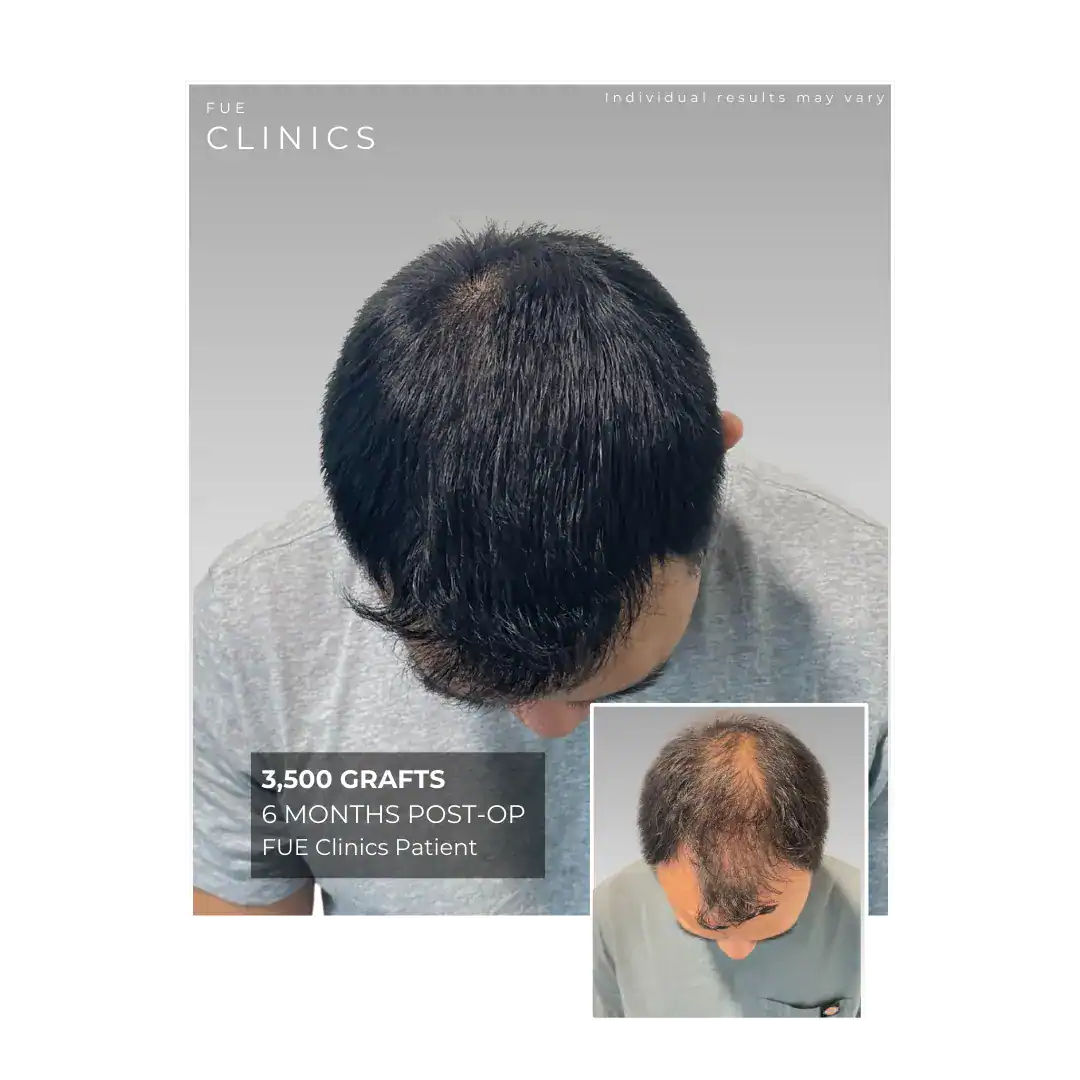 3 Results 70