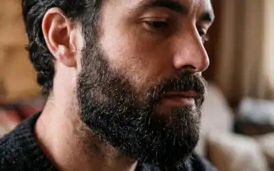 Who is a Good Candidate for a Beard Transplant?